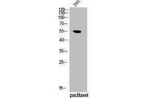 Western Blot analysis of 293 cells using Phospho-TRF1 (S219) Polyclonal Antibody (TRF1 antibody  (pSer219))