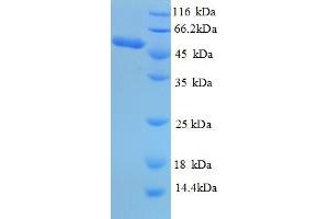 SDS-PAGE (SDS) image for Proteinase 3 (PRTN3) (AA 28-248) protein (GST tag) (ABIN4976128) (PRTN3 Protein (AA 28-248) (GST tag))