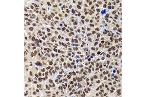 Immunohistochemistry (IHC) image for anti-Pleckstrin Homology Domain Interacting Protein (PHIP) (AA 1542-1821) antibody (ABIN6145556)