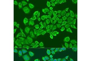 Immunofluorescence analysis of U2OS cells using IGF2BP2 Polyclonal Antibody at dilution of 1:100. (IGF2BP2 antibody)