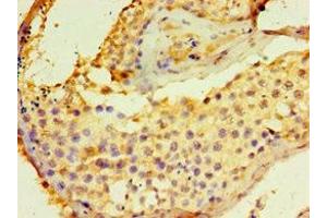 Immunohistochemistry of paraffin-embedded human testis tissue using ABIN7149845 at dilution of 1:100 (DGKE antibody  (AA 40-260))