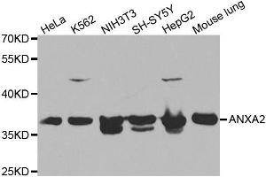 Western blot analysis of extracts of various cell lines, using ANXA2 antibody. (Annexin A2 antibody)