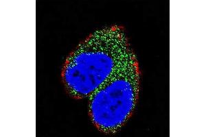 Confocal immunofluorescent analysis of AIM2 Antibody (N-term) (ABIN653833 and ABIN2843099) with MCF-7 cell followed by Alexa Fluor 488-conjugated goat anti-rabbit lgG (green). (AIM2 antibody  (N-Term))