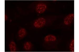 Image no. 1 for anti-Mitogen-Activated Protein Kinase-Activated Protein Kinase 2 (MAPKAPK2) (pThr334) antibody (ABIN197079) (MAPKAP Kinase 2 antibody  (pThr334))
