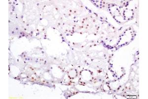 Formalin-fixed and paraffin embedded human kidney labeled with Anti-HNF4/TCF4/HNF4A Polyclonal Antibody, Unconjugated (ABIN704711) at 1:200 followed by conjugation to the secondary antibody and DAB staining (HNF4A antibody  (AA 301-400))