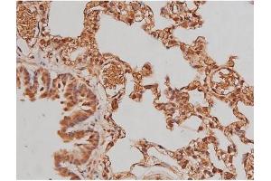 Immunohistochemistry (IHC) image for anti-Microtubule-Associated Protein tau (MAPT) (pSer262) antibody (ABIN6256228)
