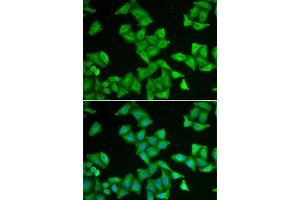 Immunofluorescence analysis of U2OS cells using COX5A antibody (ABIN6130953, ABIN6138912, ABIN6138913 and ABIN6222082). (COX5A antibody  (AA 1-150))