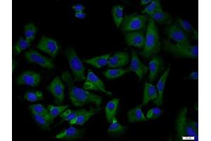 Human U2-OS cells were stained with Osteocalcin Polyclonal Antibody, Unconjugated at 1:200 in PBS and incubated for two hours at 37°C followed by Goat Anti-Rabbit IgG (H+L) FITC conjugated secondary antibody. (Osteocalcin antibody  (AA 21-100))