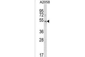 DCAF12L2 Antibody (C-term) (ABIN1537112 and ABIN2850214) western blot analysis in  cell line lysates (35 μg/lane).