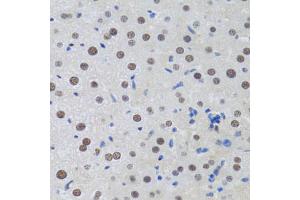 Immunohistochemistry of paraffin-embedded rat liver using MTA3 antibody (ABIN2737194) at dilution of 1:100 (40x lens). (MTA3 antibody)