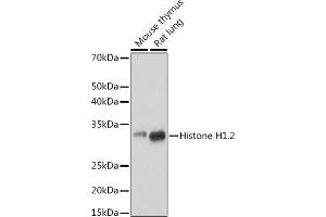 Western blot analysis of extracts of various cell lines, using Histone H1. (HIST1H1C antibody)