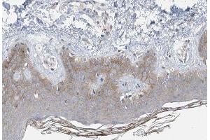 ABIN6266872 at 1/100 staining human Skin tissue sections by IHC-P. (COL14A1 antibody  (C-Term))