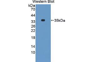 Western blot analysis of the recombinant protein. (STK3 antibody  (AA 235-460))