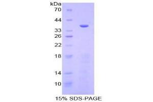 SDS-PAGE (SDS) image for Meprin A, alpha (PABA Peptide Hydrolase) (MEP1A) (AA 213-506) protein (His tag) (ABIN1879545) (MEP1A Protein (AA 213-506) (His tag))