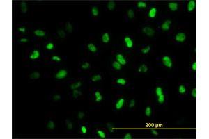 Immunofluorescence of monoclonal antibody to MEIS2 on HeLa cell. (MEIS2 antibody  (AA 1-381))