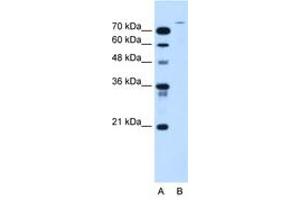 Image no. 1 for anti-Ubiquitin Specific Peptidase 48 (USP48) (AA 171-220) antibody (ABIN205064) (USP48 antibody  (AA 171-220))