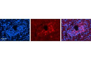Rabbit Anti-ALDOA Antibody   Formalin Fixed Paraffin Embedded Tissue: Human Liver Tissue Observed Staining: Cytoplasm in bile ductule Primary Antibody Concentration: N/A Other Working Concentrations: 1:600 Secondary Antibody: Donkey anti-Rabbit-Cy3 Secondary Antibody Concentration: 1:200 Magnification: 20X Exposure Time: 0. (ALDOA antibody  (C-Term))
