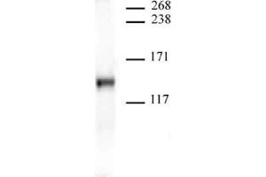 JMJD2A antibody (mAb) tested by Western blot. (KDM4A antibody  (AA 586-674))