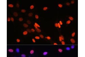 Immunofluorescence analysis of NIH-3T3 cells using DiMethyl-Histone H3-K14 Polyclonal Antibody at dilution of 1:100 (40x lens). (Histone 3 antibody  (2meLys14))
