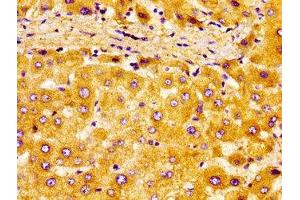 Immunohistochemistry of paraffin-embedded human liver tissue using ABIN7161906 at dilution of 1:100 (NR2F6 antibody  (AA 6-194))
