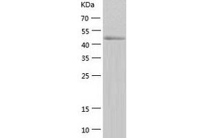Western Blotting (WB) image for Calcium/calmodulin-Dependent Protein Kinase IV (CAMK4) (AA 1-473) protein (His tag) (ABIN7287338) (CAMK4 Protein (AA 1-473) (His tag))