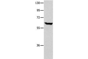 Western Blot analysis of Human seminoma tissue using DNAJC7 Polyclonal Antibody at dilution of 1:400