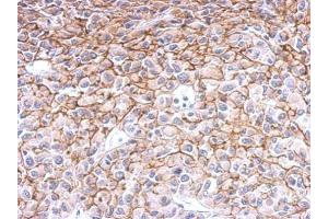 IHC-P Image Endothelin B Receptor antibody detects Ednrb protein at membrane on U87 xenograft by immunohistochemical analysis. (EDNRB antibody  (N-Term))