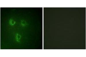 Immunofluorescence analysis of HuvEc cells, using TMEPA Antibody. (TMEPA (AA 101-150) antibody)