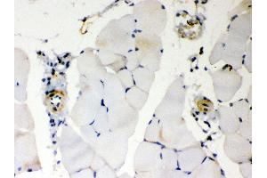 Anti- BAK Picoband antibody, IHC(P) IHC(P): Mouse Skeletal Muscle Tissue (BAK1 antibody  (AA 22-211))