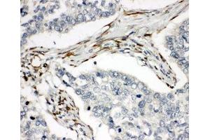 Immunohistochemistry (IHC) image for anti-Tumor Necrosis Factor Receptor Superfamily, Member 10b (TNFRSF10B) (C-Term) antibody (ABIN3029358)