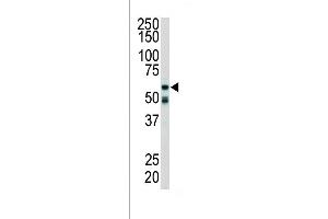 Western blot analysis of anti-RIPK2 Pab (ABIN392274 and ABIN2841944) in mouse cerebellum tissue lysate. (RIPK2 antibody  (C-Term))