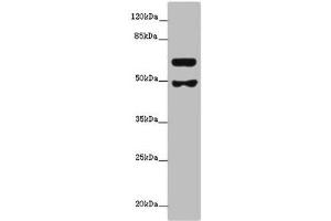 Western blot All lanes: GALNT16 antibody at 12 μg/mL + Mouse kidney tissue Secondary Goat polyclonal to rabbit at 1/10000 dilution Predicted band size: 64, 61 kDa Observed band size: 64, 49 kDa (WBSCR17 antibody  (AA 301-558))
