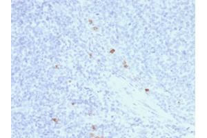 Formalin-fixed, paraffin-embedded human Tonsil stained with IgG4 Mouse Recombinant Monoclonal Antibody (rIGHG4/1345). (Recombinant IGHG4 antibody)