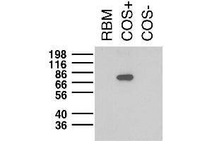 Immunoblot on adult rat brain membrane (RBM) and lysates from Kv1.