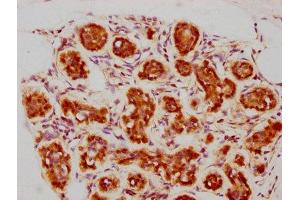 IHC image of ABIN7127361 diluted at 1:73. (Recombinant BAG3 antibody)