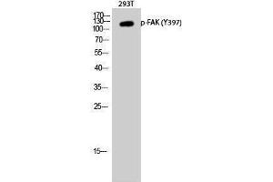 Western Blotting (WB) image for anti-PTK2 Protein tyrosine Kinase 2 (PTK2) (pTyr397) antibody (ABIN3179687) (FAK antibody  (pTyr397))