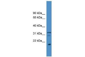 VEGFB antibody used at 0. (VEGFB antibody  (C-Term))