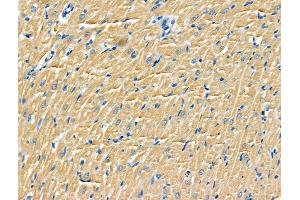 ABIN6264860 and ABIN6266755 at 1/100 staining Rat heart tissue by IHC-P. (RPS9 antibody  (Internal Region))