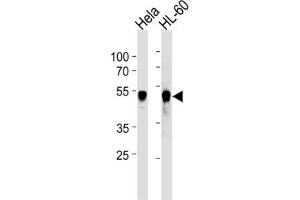 Western Blotting (WB) image for anti-Vaccinia Related Kinase 1 (VRK1) antibody (ABIN2905796) (VRK1 antibody)