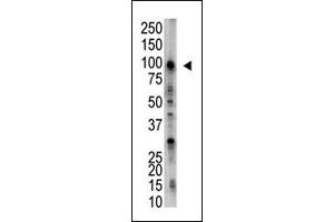 Image no. 1 for anti-Ubiquitin Specific Peptidase 5 (USP5) (C-Term) antibody (ABIN357529) (USP5 antibody  (C-Term))