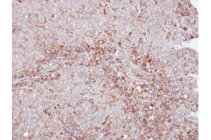 IHC-P Image Immunohistochemical analysis of paraffin-embedded DLD1 xenograft, using MMP12, antibody at 1:500 dilution. (MMP12 antibody)