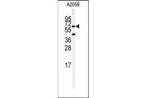 Image no. 1 for anti-Butyrylcholinesterase (BCHE) (Middle Region) antibody (ABIN360174)