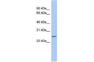 WB Suggested Anti-LYPD5 Antibody Titration: 0.