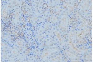 ABIN6279381 at 1/100 staining Mouse kidney tissue by IHC-P. (DYNC1H1 antibody  (Internal Region))
