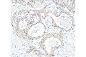 Immunohistochemistry (IHC) image for anti-KIAA1524 (KIAA1524) (AA 853-903) antibody (ABIN7453880)