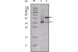 Western Blot showing ESR1 antibody used against truncated ESR1-His recombinant protein (1) and truncated Trx-ESR1 recombinant protein (2). (Estrogen Receptor alpha antibody  (AA 301-595))