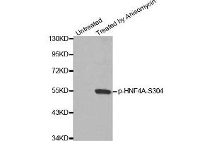 Western Blotting (WB) image for anti-Hepatocyte Nuclear Factor 4, alpha (HNF4A) (pSer304) antibody (ABIN1870237) (HNF4A antibody  (pSer304))