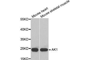 Western blot analysis of extracts of mouse heart and mouse keletal muscel tissues, using AK1 antibody. (Adenylate Kinase 1 antibody)