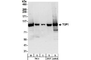 Western Blotting (WB) image for anti-Topoisomerase (DNA) I (TOP1) (AA 715-765) antibody (ABIN7450832) (Topoisomerase I antibody  (AA 715-765))
