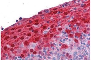 Human Tonsil: Formalin-Fixed, Paraffin-Embedded (FFPE) (S100A7 antibody  (AA 18-30))